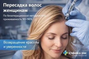 Пересадка волос женщинам: современные методы восстановления густоты и роль безоперационной технологии HFE