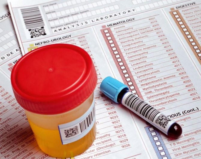Urine and blood tests