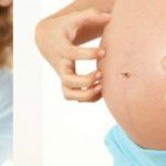 Атопический дерматит у беременной женщины