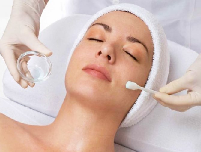 what is glycolic facial peeling