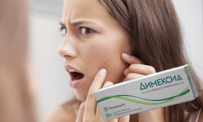 Dimexide - for acne-free skin!