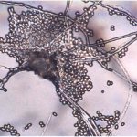 Грибок мицелий - причины появления, какие виды бывают