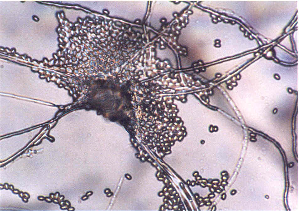 Грибок мицелий - причины появления, какие виды бывают