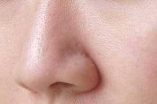 How to clean pores on your face at home. How to clean facial pores at home 