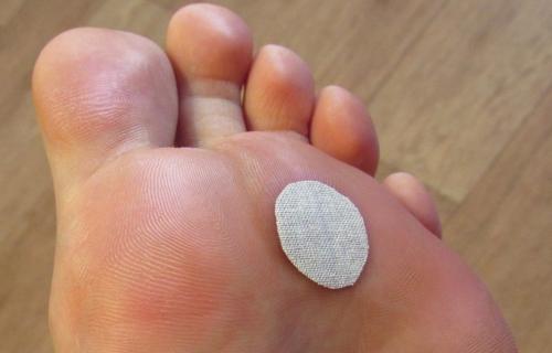 Treatment for corns on the feet is quick. Removal using anti-callus creams, ointments or patches 