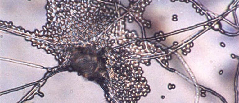 Патогенные грибы — споры и мицелий на пальцах рук