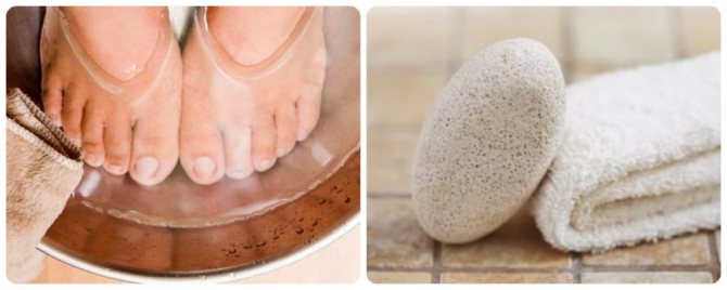 Foot steaming and pumice stone treatment