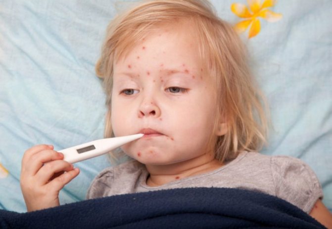 Сыпь на теле у ребенка мелкая и красная: виды, причины и лечение