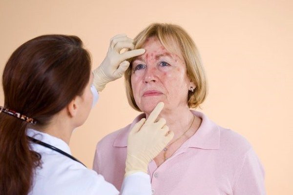 Doctor examining patient&#39;s skin